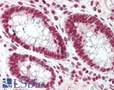 Human Tonsil: Formalin-Fixed, Paraffin-Embedded (FFPE)