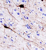 Parvalbumin alpha in Human Brain. Parvalbumin alpha was detected in immersion fixed paraffin-embedded sections of human brain (cortex) using 5 ug/ml Sheep Anti-Human/Mouse/Rat Parvalbumin alpha Antigen Affinity-purified Polyclonal Antibody overnight at 4°C. Tissue was stained with Anti-Sheep HRP-DAB (brown) and counterstained with hematoxylin (blue).
