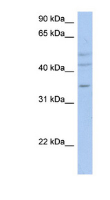 ACPL2 antibody LS-C110988 Western blot of OVCAR-3 cell lysate.
