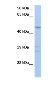 ACPL2 antibody LS-C110989 Western blot of THP-1 cell lysate.