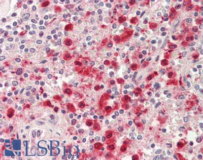 Human Spleen: Formalin-Fixed, Paraffin-Embedded (FFPE)