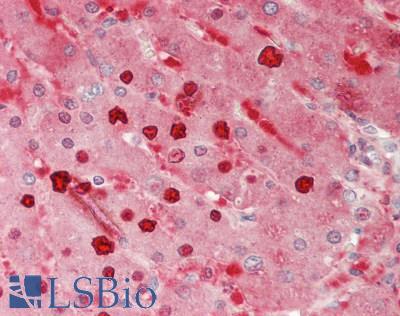 Human Liver: Formalin-Fixed, Paraffin-Embedded (FFPE)
