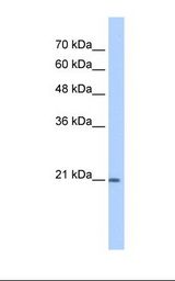 HepG2 cell lysate. Antibody concentration: 1.0 ug/ml. Gel concentration: 12%.