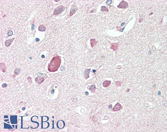 Anti-PTGDS / PGDS antibody IHC staining of human brain, cortex. Immunohistochemistry of formalin-fixed, paraffin-embedded tissue after heat-induced antigen retrieval. Antibody LS-B10597 concentration 5 ug/ml.