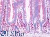 Anti-Prostaglandin D2 Receptor antibody LS-A503 IHC of human small intestine, villi. Immunohistochemistry of formalin-fixed, paraffin-embedded tissue after heat-induced antigen retrieval.