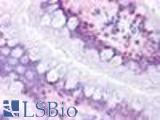 Anti-Prostaglandin D2 Receptor antibody LS-A8133 IHC of human small intestine. Immunohistochemistry of formalin-fixed, paraffin-embedded tissue after heat-induced antigen retrieval.