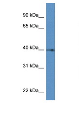 PTGDR antibody LS-C135958 Western blot of HeLa Cell lysate. Antibody concentration 1 ug/ml.