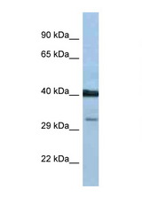 PTGDR antibody LS-C145501 Western blot of 1 Cell lysate. Antibody concentration 1 ug/ml.