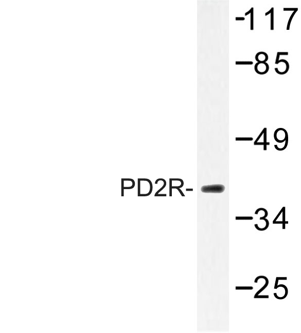 Western blot of PD2R (E301) pAb in extracts from HepG2 cells.