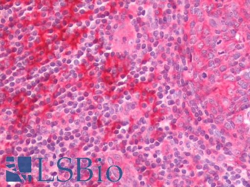 Human Tonsil: Formalin-Fixed, Paraffin-Embedded (FFPE)
