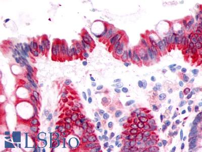 Anti-Prostaglandin D2 Receptor antibody LS-A3279 IHC of human colon, epithelium. Immunohistochemistry of formalin-fixed, paraffin-embedded tissue after heat-induced antigen retrieval.