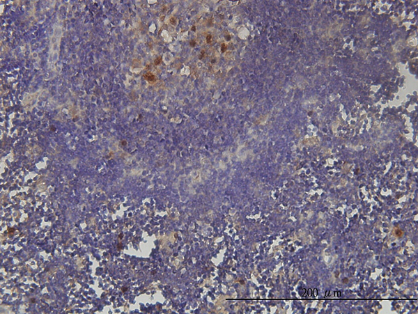 Immunoperoxidase of monoclonal antibody to KIAA0101 on formalin-fixed paraffin-embedded human lymph node tissue. [antibody concentration 3 ug/ml].