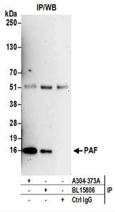 Detection of Human PAF by Western Blot of Immunoprecipitates. Samples: Whole cell lysate (0.5 or 1.0 mg per IP reaction; 20% of IP loaded) prepared using RIPA buffer from HeLa cells. Antibodies: Affinity purified rabbit anti-PAF antibody used for IP at 6 ug per reaction. PAF was also immunoprecipitated by rabbit anti-PAF antibody BL15806. For blotting immunoprecipitated PAF, was used at 1 ug/ml. Detection: Chemiluminescence with an exposure time of 3 minutes.