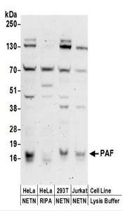 Detection of Human PAF by Western Blot. Samples: Whole cell lysate (50 ug) prepared using NETN or RIPA buffer from HeLa, 293T, and Jurkat cells. Antibodies: Affinity purified rabbit anti-PAF antibody used for WB at 0.1 ug/ml. Detection: Chemiluminescence with an exposure time of 3 minutes.
