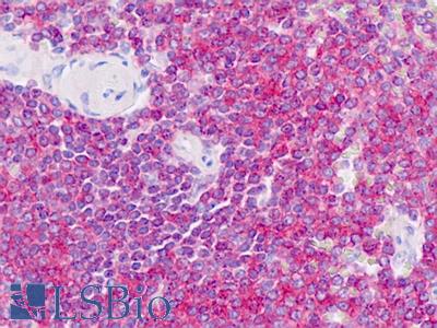 Anti-RAC1/RAC2 antibody IHC staining of human spleen. Immunohistochemistry of formalin-fixed, paraffin-embedded tissue after heat-induced antigen retrieval.