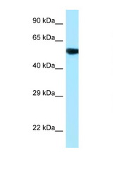 PAG1 / PAG antibody LS-C146554 Western blot of 721_B Cell lysate. Antibody concentration 1 ug/ml.