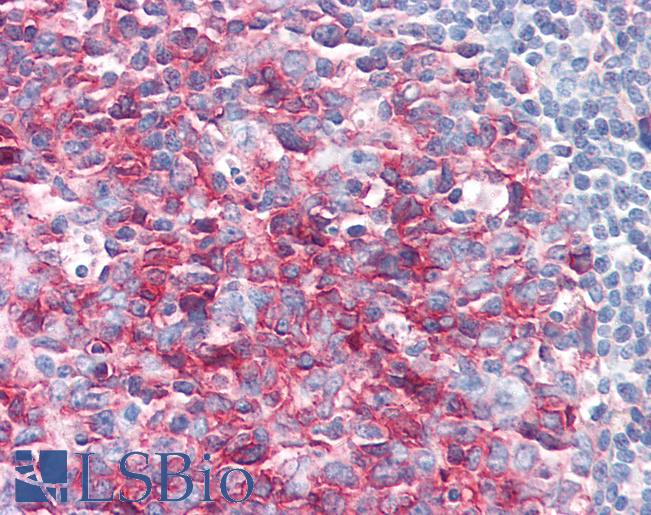 Anti-PAG1 / PAG antibody IHC of human tonsil. Immunohistochemistry of formalin-fixed, paraffin-embedded tissue after heat-induced antigen retrieval. Antibody LS-B2796 concentration 10 ug/ml.