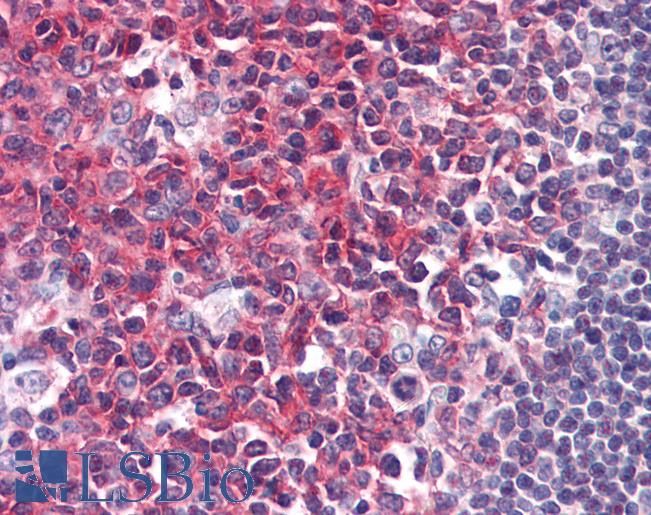 Anti-PAG1 / PAG antibody IHC of human tonsil. Immunohistochemistry of formalin-fixed, paraffin-embedded tissue after heat-induced antigen retrieval. Antibody LS-B2795 concentration 10 ug/ml.