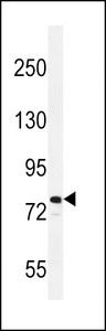 RAD54 Antibody western blot of NCI-H460 cell line lysates (35 ug/lane). The RAD54 antibody detected the RAD54 protein (arrow).