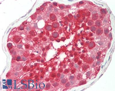 Human Testis: Formalin-Fixed, Paraffin-Embedded (FFPE)