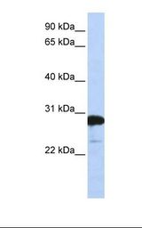 721_B cell lysate. Antibody concentration: 1.0 ug/ml. Gel concentration: 12%.