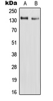 Western blot analysis of RAPH1 expression in HepG2 (A); H9C2 (B) whole cell lysates.