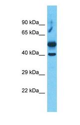 Western blot of RAPSN Antibody with human Uterus Tumor lysate.