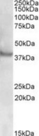 RAPSN antibody (0.5 ug/ml) staining of Human Skeletal Muscle lysate (35 ug protein in RIPA buffer). Primary incubation was 1 hour. Detected by chemiluminescence.