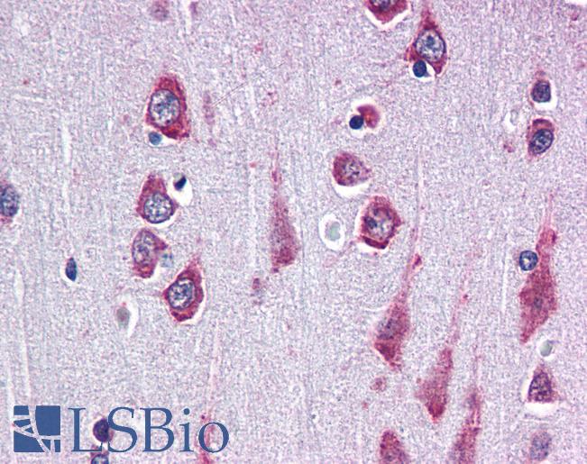 Anti-RAPSN / RAPSYN antibody IHC of human brain, cortex. Immunohistochemistry of formalin-fixed, paraffin-embedded tissue after heat-induced antigen retrieval. Antibody LS-B2626 concentration 20 ug/ml.