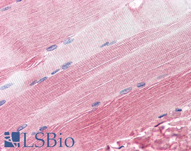 Anti-RAPSN / RAPSYN antibody IHC of human skeletal muscle. Immunohistochemistry of formalin-fixed, paraffin-embedded tissue after heat-induced antigen retrieval. Antibody LS-B2633 concentration 20 ug/ml.
