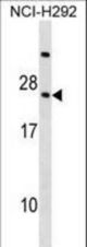 RARRES3 Antibody western blot of NCI-H292 cell line lysates (35 ug/lane). The RARRES3 antibody detected the RARRES3 protein (arrow).