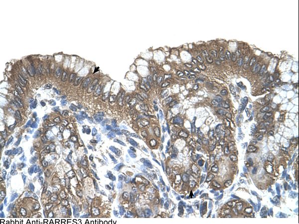 RARRES3 antibody LS-C80895 was used in IHC to stain formalin-fixed, paraffin-embedded human stomach.