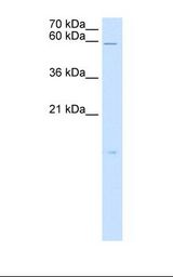 HepG2 cell lysate. Antibody concentration: 5.0 ug/ml. Gel concentration: 15%.