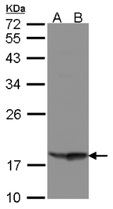 Sample (30 ug of whole cell lysate). A: Raji, B: MOLT4. 12% SDS PAGE. RARRES3 / RIG1 antibody diluted at 1:1000