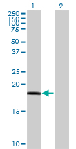 Western Blot analysis of RARRES3 expression in transfected 293T cell line by RARRES3 monoclonal antibody (M10), clone 1H5.Lane 1: RARRES3 transfected lysate(18.2 KDa).Lane 2: Non-transfected lysate.