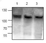 Western blot of RASA1 / RASGAP antibody LS-C48306.