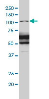 RASA1 monoclonal antibody (M01), clone 2C12 Western blot of RASA1 expression in IMR-32.