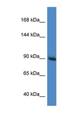 RASA1 antibody LS-C135002 Western blot of Mouse Brain lysate. Antibody concentration 1 ug/ml.