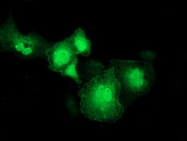 Anti-RASD2 mouse monoclonal antibody immunofluorescent staining of COS7 cells transiently transfected by pCMV6-ENTRY RASD2.