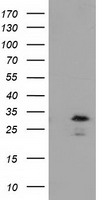 HEK293T cells were transfected with the pCMV6-ENTRY control (Left lane) or pCMV6-ENTRY RASD2 (Right lane) cDNA for 48 hrs and lysed. Equivalent amounts of cell lysates (5 ug per lane) were separated by SDS-PAGE and immunoblotted with anti-RASD2.