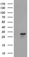 HEK293T cells were transfected with the pCMV6-ENTRY control (Left lane) or pCMV6-ENTRY RASD2 (Right lane) cDNA for 48 hrs and lysed. Equivalent amounts of cell lysates (5 ug per lane) were separated by SDS-PAGE and immunoblotted with anti-RASD2.