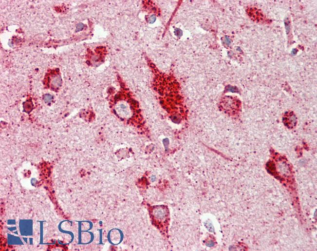 Anti-RASD2 / RHES / DEXRAS1 antibody IHC staining of human brain, cortex. Immunohistochemistry of formalin-fixed, paraffin-embedded tissue after heat-induced antigen retrieval. Antibody LS-B10692 dilution 1:75.