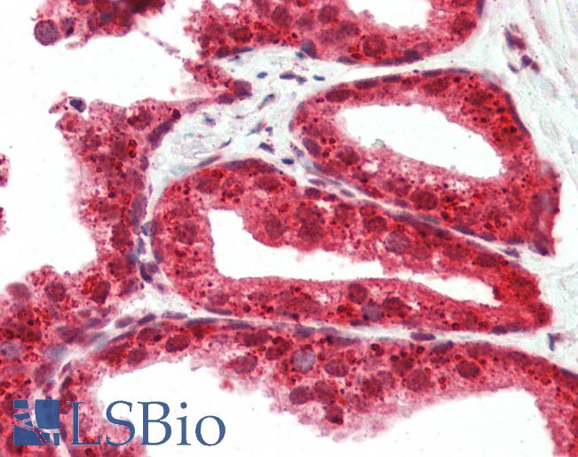 Anti-RASD2 antibody IHC of human prostate. Immunohistochemistry of formalin-fixed, paraffin-embedded tissue after heat-induced antigen retrieval. Antibody LS-B3212 concentration 5 ug/ml.