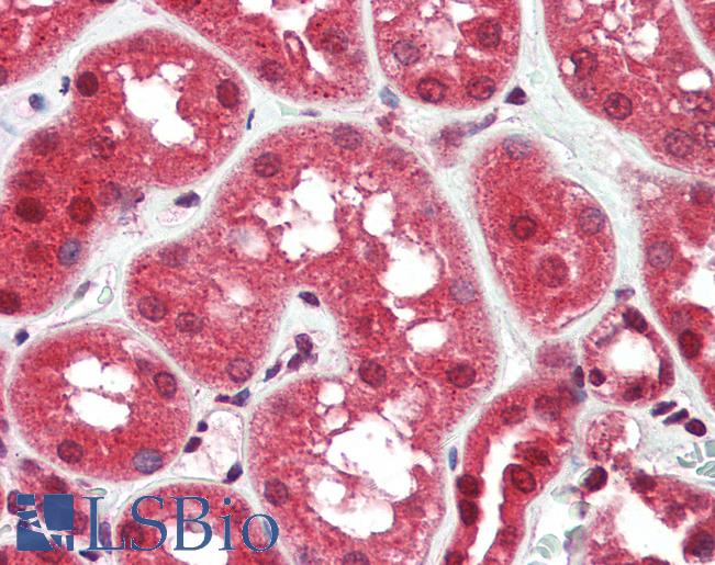 Anti-RASD2 antibody IHC of human kidney. Immunohistochemistry of formalin-fixed, paraffin-embedded tissue after heat-induced antigen retrieval. Antibody LS-B3212 concentration 5 ug/ml.