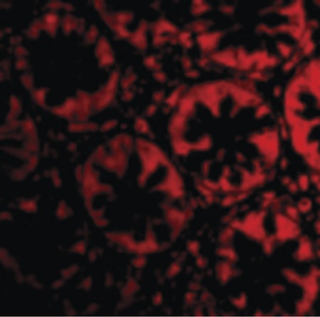 Immunofluorescence of TEM2 in Human Colon cells with TEM2 antibody at 20 ug/ml.