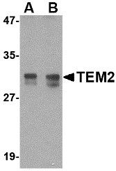Western blot of TEM2 in rat colon tissue lysate with TEM2 antibody at (A) 1 and (B) 2 ug/ml. Below: Immunohistochemistry of TEM2 in human colon tissue with TEM2 antibody at 2.5 ug/ml.