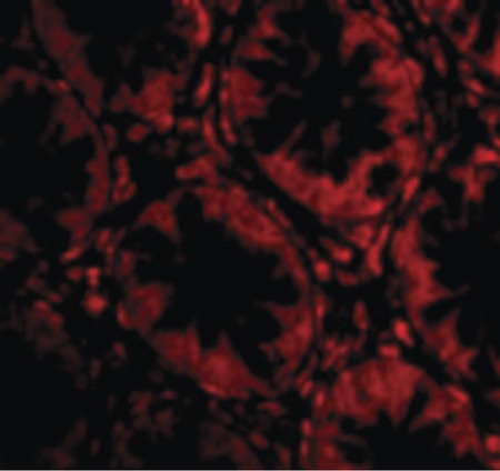 Immunofluorescence of TEM2 in Human Colon cells with TEM2 antibody at 20 ug/ml.