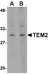 Western blot of TEM2 in human colon tissue lysate with TEM2 antibody at (A) 1 and (B) 2 ug/ml. Below: Immunohistochemistry of TEM2 in human colon tissue with TEM2 antibody at 2.5 ug/ml.
