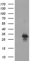 HEK293T cells were transfected with the pCMV6-ENTRY control (Left lane) or pCMV6-ENTRY RASD2 (Right lane) cDNA for 48 hrs and lysed. Equivalent amounts of cell lysates (5 ug per lane) were separated by SDS-PAGE and immunoblotted with anti-RASD2.