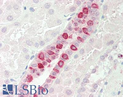 Human Kidney: Formalin-Fixed, Paraffin-Embedded (FFPE)
